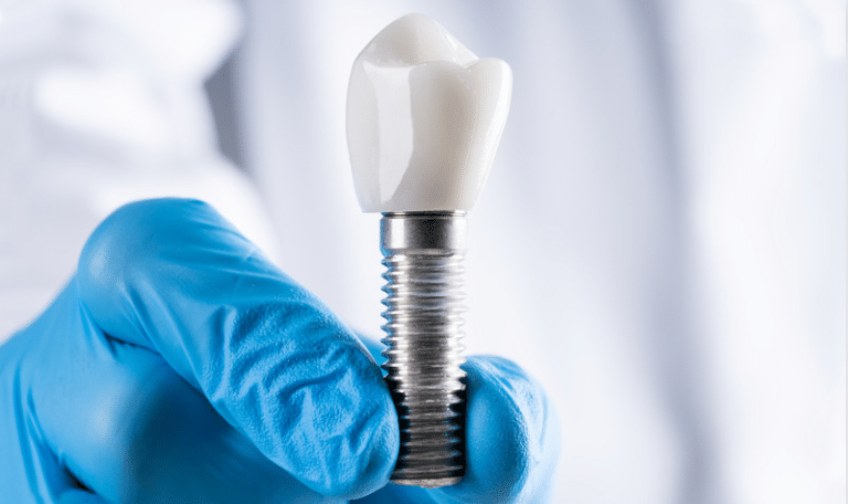Dental Implants Brighton