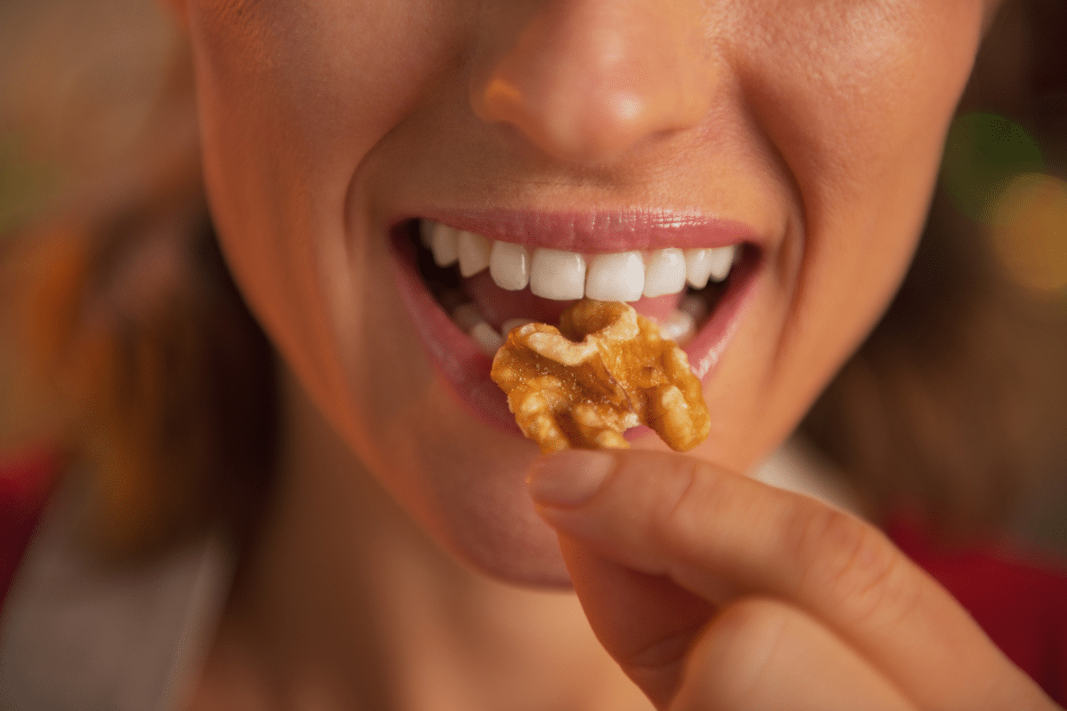 Does Food Get Stuck Under Dental Implants? Know from Our Brighton Team